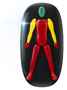 Movement affected to a high degree in the body and legs, mildly affected in the arms with hand grip and control highly affected.