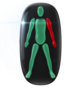The movement in one arm affected to a high degree.