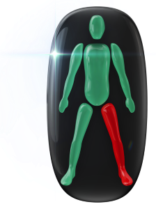 The movement of one leg affected to a high degree.