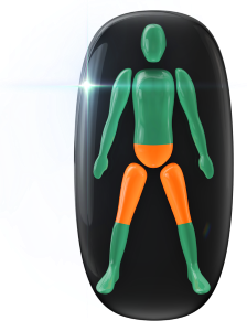 Movement of the hip joint moderately affected.