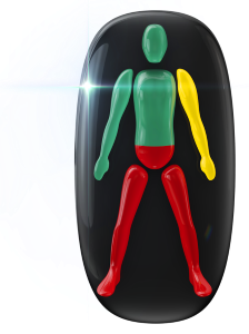 Movement highly affected in the lower trunk and legs, with one arm also mildly affected.