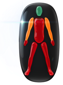 Movement affected to a high degree in the trunk, legs and hands with movement moderately affected in the arms.