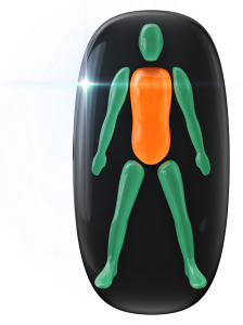 Movement and twisting ability affected to a moderate degree in the trunk and body.