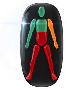 Movement highly affected in the mid-trunk and legs, with one arm also moderately affected.