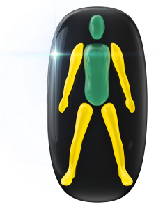 Movement and coordination mildly affected in both arms and both legs.