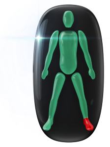 Highly affected movement in one foot and ankle.