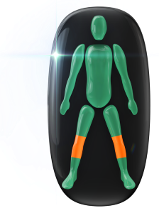 Movement moderately affected in both knees.