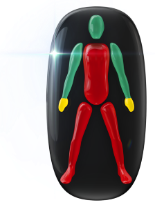 Movement or coordination highly affected throughout the trunk and legs with grip mildly affected in the hands.