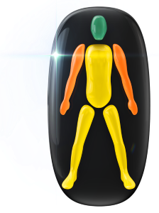 Movement and coordination mildly affected in the trunk and legs with the arms moderately affected.