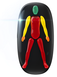 Movement or coordination highly affected throughout the trunk and legs with the arms mildly affected and grip moderately affected in the hands.