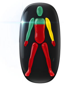 Movement and coordination highly affected in the trunk, legs and hands, with one arm also affected to a mild degree.