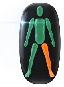 Movement and coordination moderately affected in one leg.