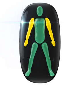 Movement and coordination mildly affected in both arms.