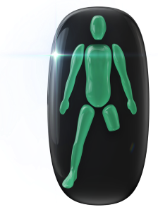 Absence of one leg, mid-thigh.