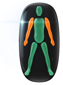 Moderately affected movement in both arms.