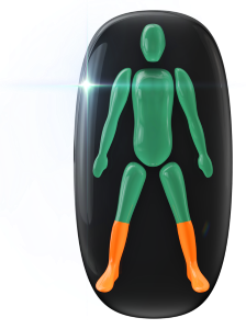 Moderately affected movement and coordination in both lower legs.