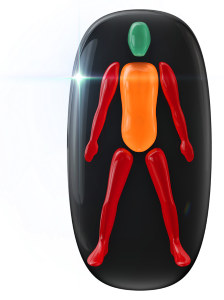 Highly affected movement in both arms and both legs, with movement in trunk affected to a moderate degree.