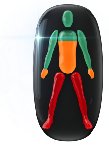 Movement moderately affected in the trunk from the chest and also in the hands, with movement in the legs highly affected.