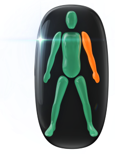 Movement moderately affected in one arm.