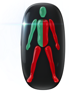 Movement and coordination affected to a high degree on one side of the body, one arm and both legs.