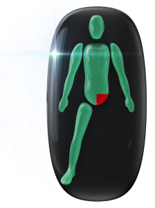 The absence of one leg and affected hip joint.
